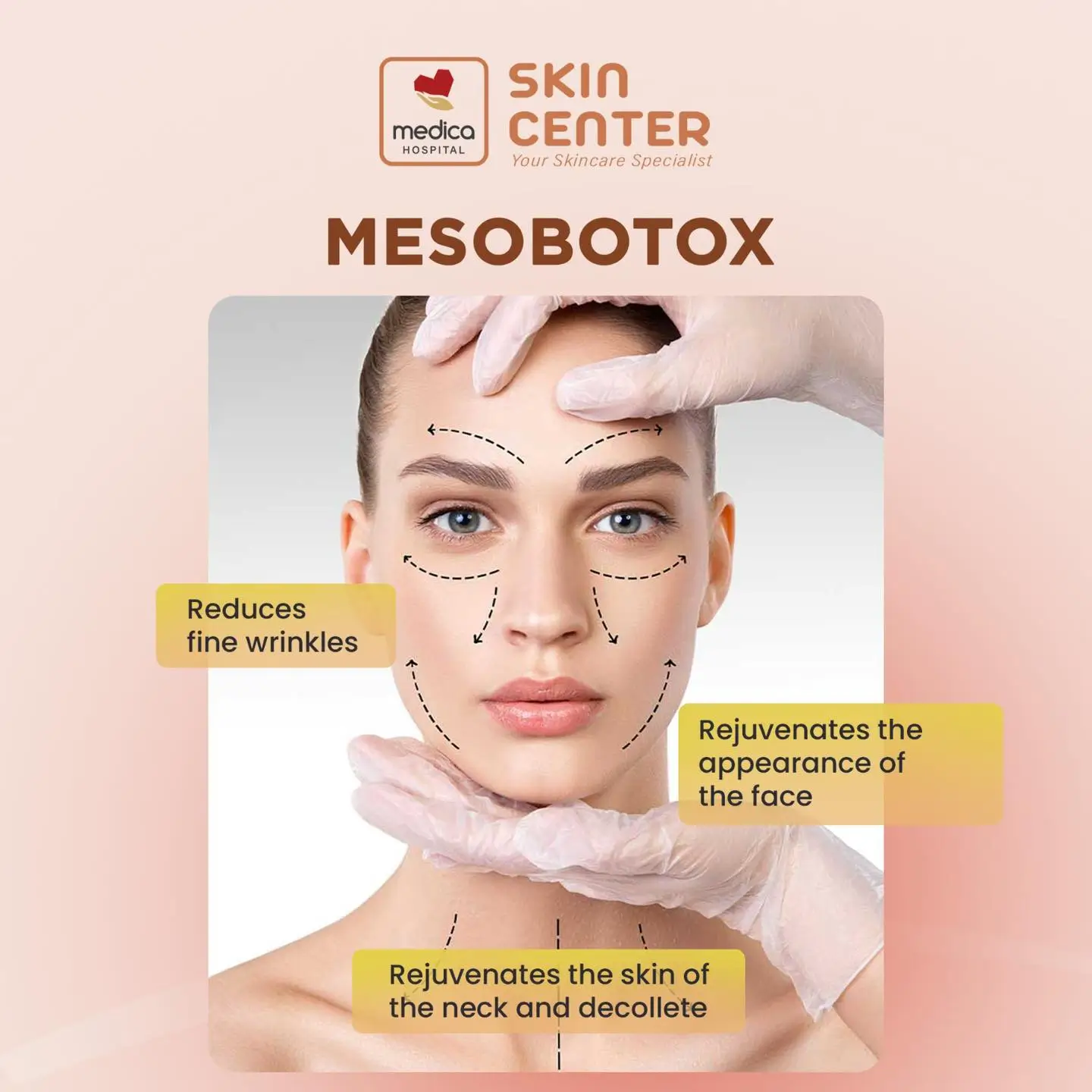 mesobotox 1