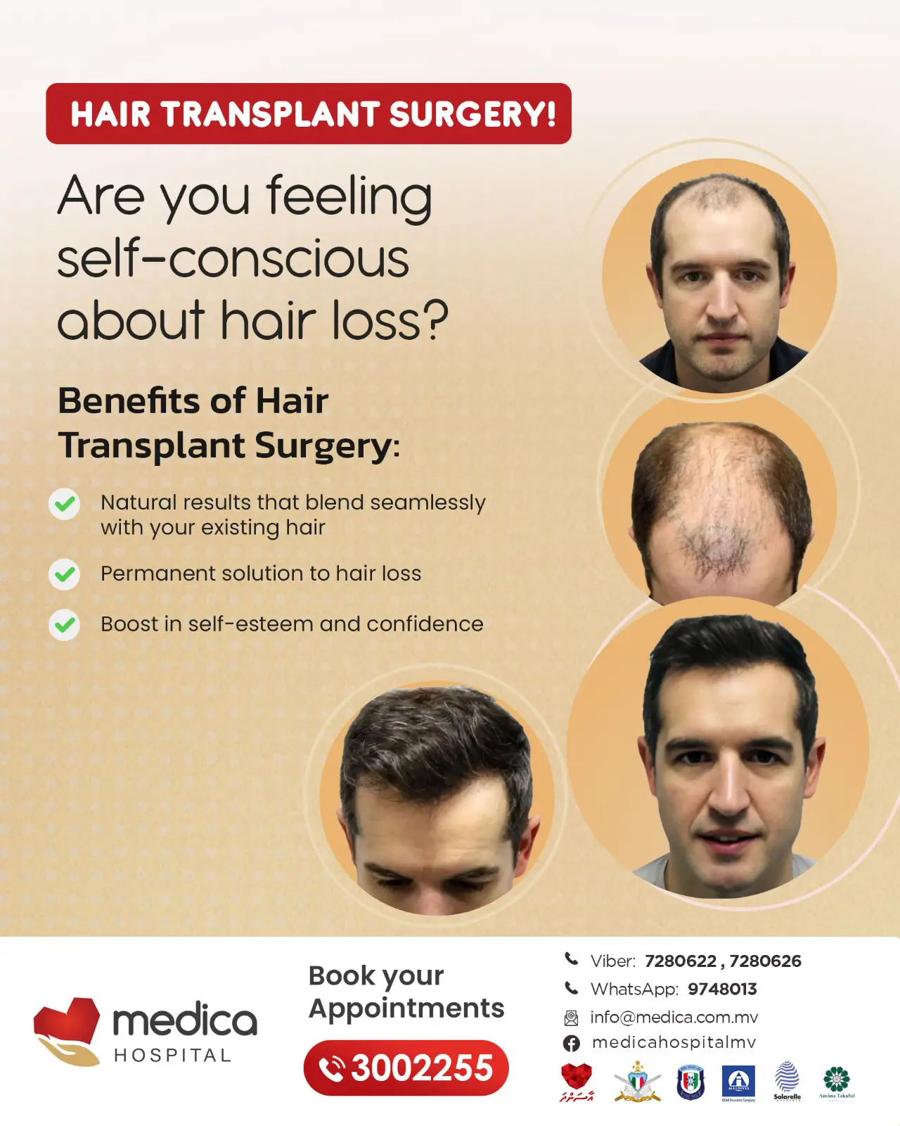 are you feeling self concisous about hair loss