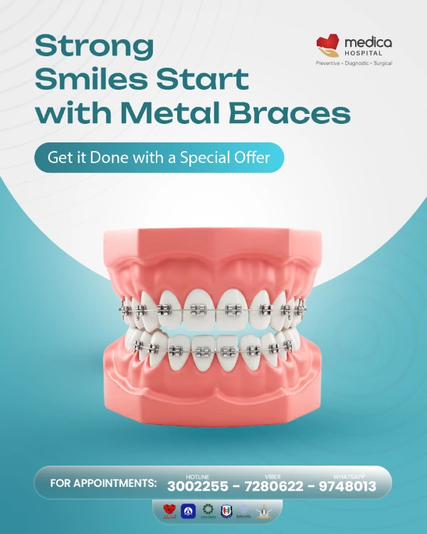 braces AD